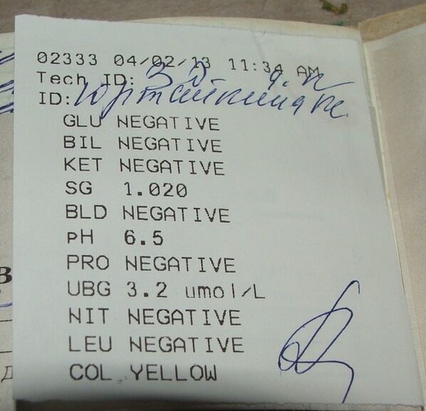 My urine analysis is before Femixal